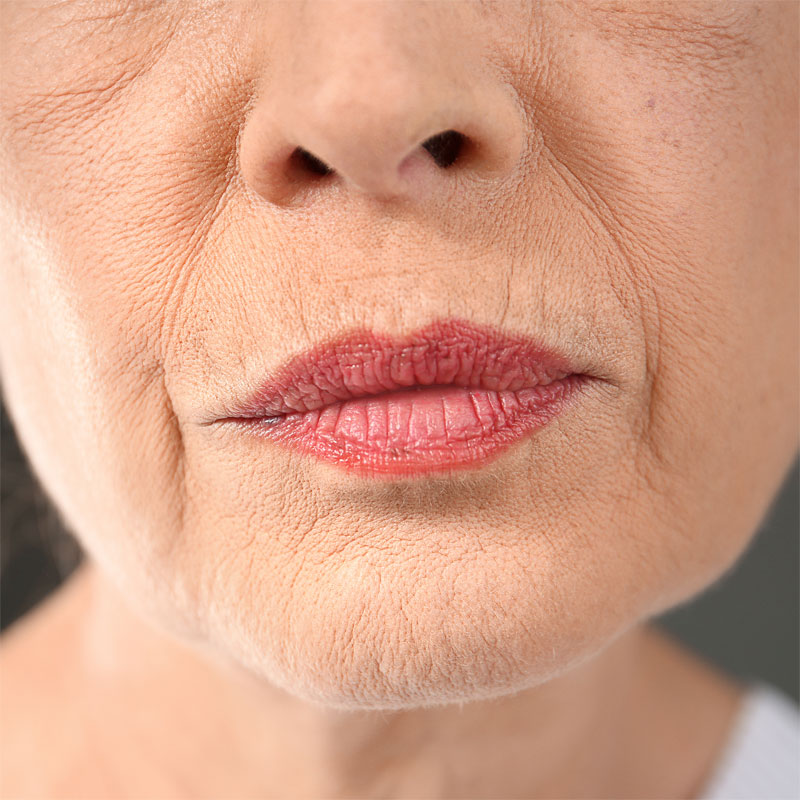 Visage femme avant une pressothérapie